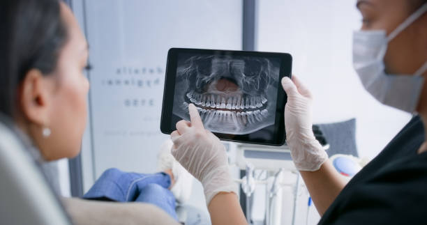 Licensed Tooth Extraction service in San Juan Capistrano, CA - Smile Center Dentistry